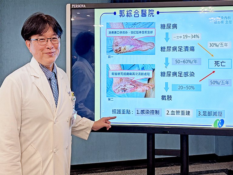 醫談糖尿病足感染　足部潰瘍傷口是警訊